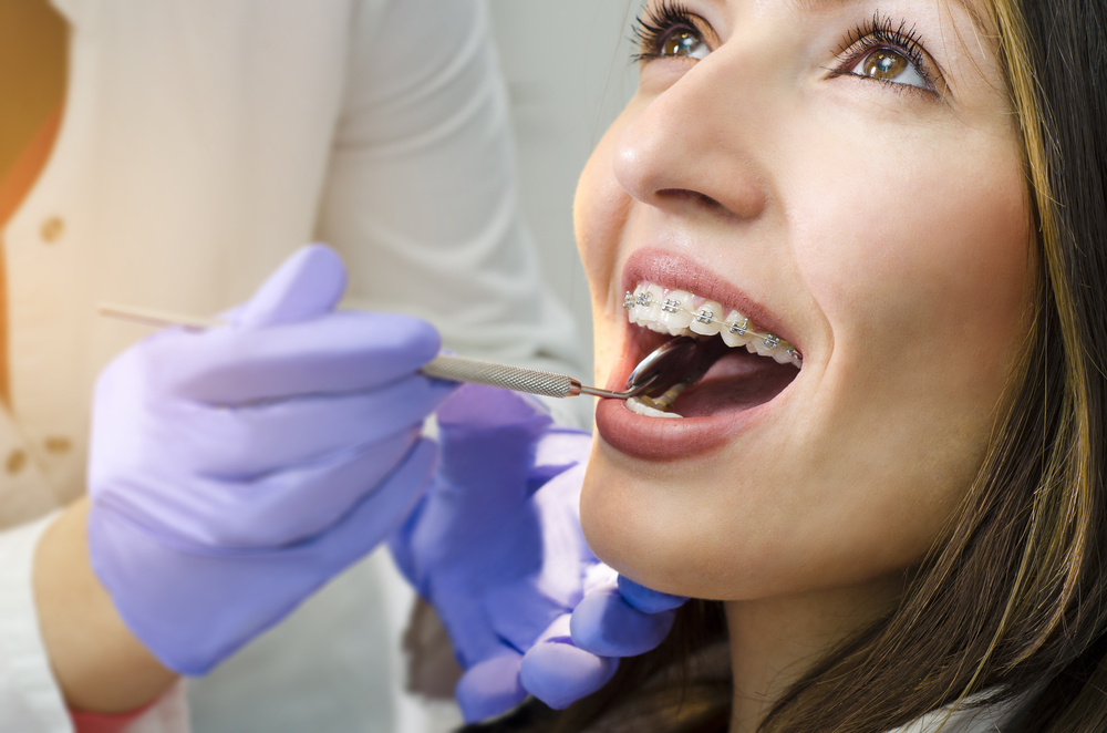 woman getting a braces dental checkup